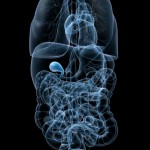 Холецистэктомия