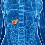 Чем является воспаление желчного пузыря?