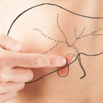 Массаж желчного пузыря