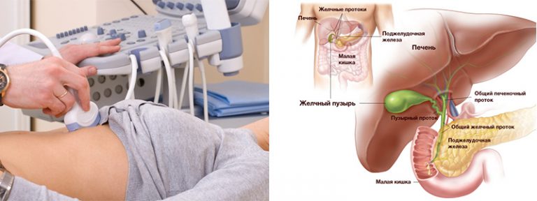 Подготовка к УЗИ органов брюшной полости общие