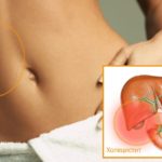 Воспаление желчного пузыря