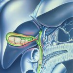 Шиповник после удаления желчного пузыря