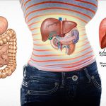 Контактный литолиз желчных камней где делают