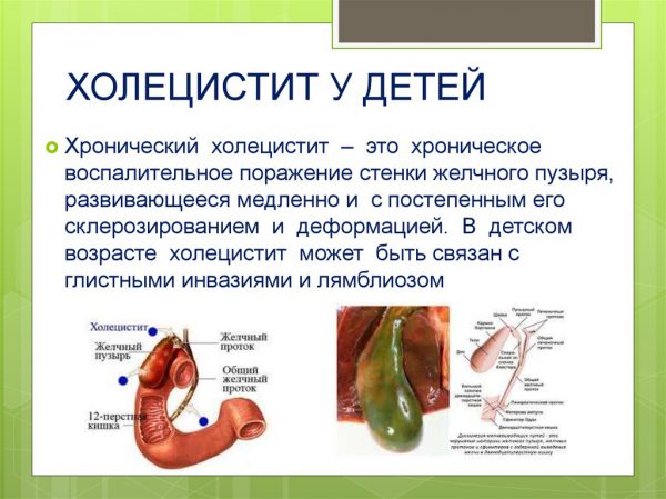 Стол при болезни желчного пузыря