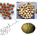 Камни в желчном пузыре у пожилого человека