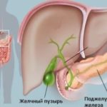 Болит печень после удаления желчного пузыря