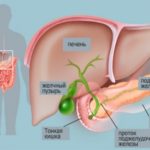 Атония желчного пузыря
